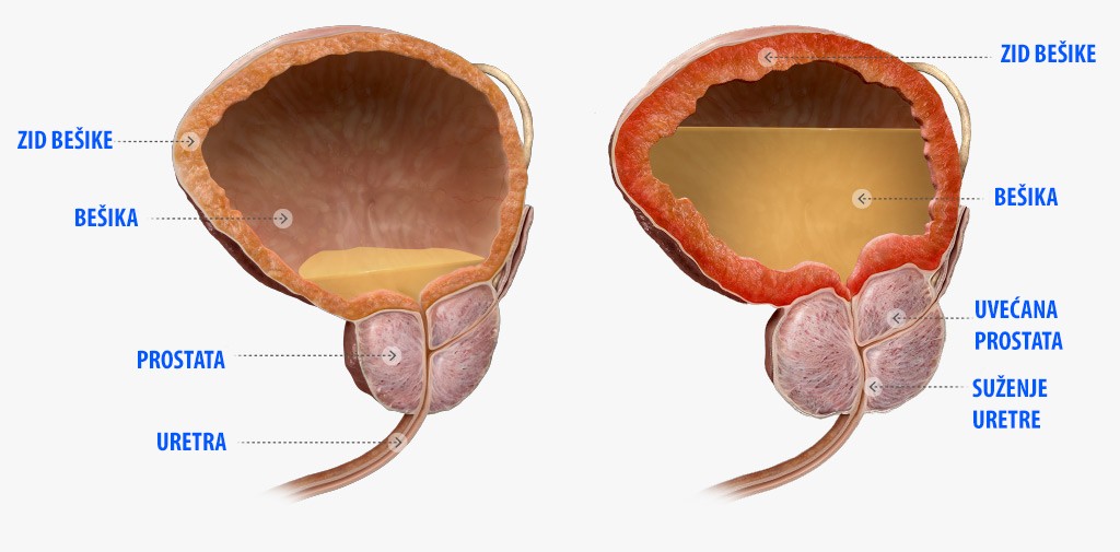 Rezultat slika za prostata